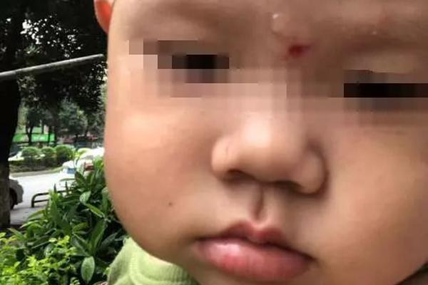 IS首领5年来首露面:承认失败 扬言向西方“复仇”_挂机宝端口映射
