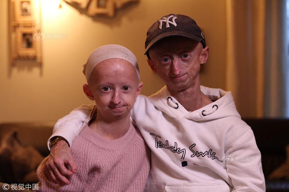 在线观看：奥黛丽·赫本与梅尔·费勒的婚礼