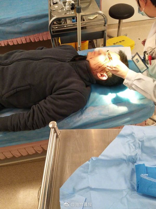 医院飞身擒小偷!见义勇为的身影中又见退役军人_挂机宝开发环境