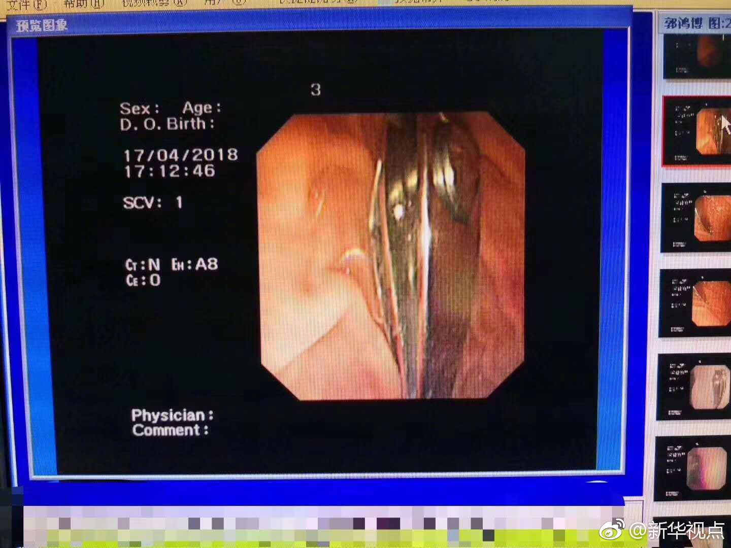 动力强劲还不挑油 东风日产新天籁2.0T